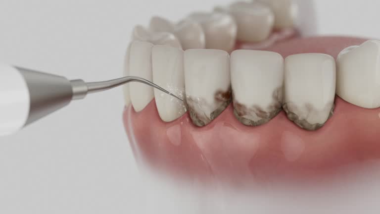 Trusted Dental Implants service in Colesville, MD - Dentist Open Now